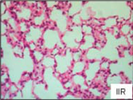 Mesenteric ischemia reperfusion